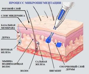 процесс микропигментации